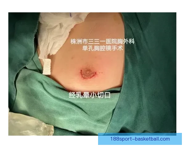 坎宁安气胸康复持续推进 活塞计划一周后复查评估